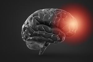 bigstock brain inflammation or other pr 367259743